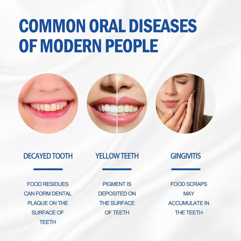 CIBAMU SP-4 Probiotic Whitening Toothpaste (Pack of 4)